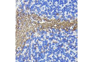 Immunohistochemistry of paraffin-embedded mouse cerebellum using CNPase Rabbit mAb (ABIN7265322) at dilution of 1:100 (40x lens). (Cnpase antibody)