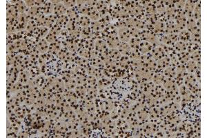 ABIN6267174 at 1/100 staining Mouse kidney tissue by IHC-P. (SF3B1 antibody  (pThr313))
