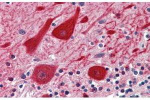 Rabbit Anti-EMX2 Antibody  Paraffin Embedded Tissue: Human Brain, cerebellum Antibody Concentration: 5 ug/ml Magnification: 400X