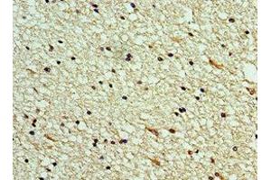 Immunohistochemistry of paraffin-embedded human brain tissue using ABIN7146050 at dilution of 1:100 (CLEC11A antibody  (AA 22-323))