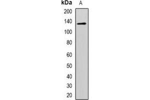 Western blot analysis of CD146 expression in Hela (A) whole cell lysates. (MCAM antibody)