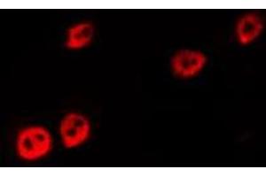 Immunofluorescence (fixed cells) (IF/ICC) image for anti-Tumor Protein P53 (TP53) (pSer366) antibody (ABIN6255262)