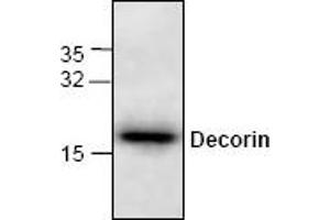 Image no. 1 for anti-Decorin (DCN) antibody (ABIN264841) (Decorin antibody)