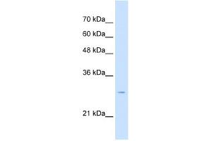 WB Suggested Anti-TSPAN32 Antibody Titration:  2. (TSPAN32 antibody  (Middle Region))