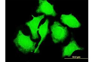 Immunofluorescence of monoclonal antibody to TCL1A on HeLa cell. (TCL1A antibody  (AA 61-114))