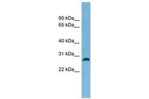 Image no. 1 for anti-Steroid-5-alpha-Reductase, alpha Polypeptide 2 (3-Oxo-5 alpha-Steroid delta 4-Dehydrogenase alpha 2) (SRD5A2) (AA 35-84) antibody (ABIN6744768) (SRD5A2 antibody  (AA 35-84))