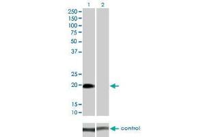 Western blot analysis of STK32A over-expressed 293 cell line, cotransfected with STK32A Validated Chimera RNAi (Lane 2) or non-transfected control (Lane 1). (STK32A antibody  (AA 1-166))
