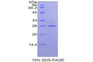 SDS-PAGE (SDS) image for Cardiotrophin-Like Cytokine Factor 1 (CLCF1) (AA 28-225) protein (His tag) (ABIN1877912) (CLCF1 Protein (AA 28-225) (His tag))