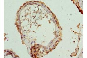 Immunohistochemistry (IHC) image for anti-Chaperonin Containing TCP1, Subunit 5 (Epsilon) (CCT5) (AA 1-270) antibody (ABIN7171417)
