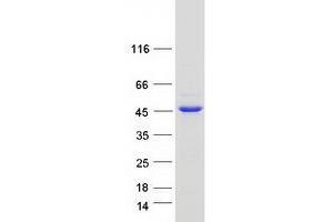 Western Blotting (WB) image for Inositol-Tetrakisphosphate 1-Kinase (ITPK1) (Transcript Variant 1) protein (Myc-DYKDDDDK Tag) (ABIN2723914)