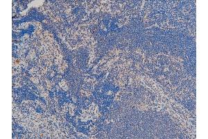 ABIN6267554 at 1/100 staining rat thymus tissue sections by IHC-P.