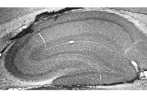 Adult rat hippocampus immunohistochemistry. (ATAD1 antibody  (AA 1-361))