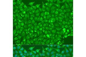 Immunofluorescence analysis of U2OS cells using FLT4 Polyclonal Antibody at dilution of 1:100. (FLT4 antibody)