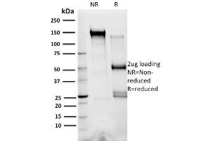 SDS-PAGE Analysis Purified XRCC3 Mouse Monoclonal Antibody (10F1/6).
