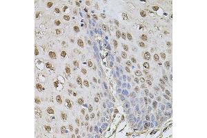 Immunohistochemistry of paraffin-embedded human esophagus using CCNA2 antibody (ABIN1871532) at dilution of 1:100 (40x lens).