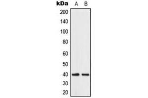 Western blot analysis of ABHD12B expression in human brain (A), K562 (B) whole cell lysates. (ABHD12B antibody  (C-Term))
