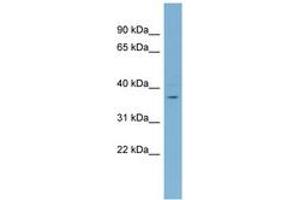 Image no. 1 for anti-XiAP Associated Factor 1 (XAF1) (AA 215-264) antibody (ABIN6742142) (XAF1 antibody  (AA 215-264))