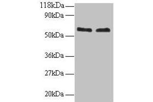 Western blot All lanes: FUS antibody at 2 μg/mL Lane 1: 293T whole cell lysate Lane 2: EC109 whole cell lysate Secondary Goat polyclonal to rabbit IgG at 1/15000 dilution Predicted band size: 54 kDa Observed band size: 60 kDa