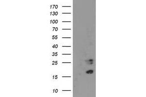 HEK293T cells were transfected with the pCMV6-ENTRY control (Left lane) or pCMV6-ENTRY CDKN3 (Right lane) cDNA for 48 hrs and lysed. (CDKN3 antibody)