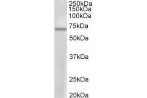 Western Blotting (WB) image for anti-Protein Arginine Methyltransferase 3 (PRMT3) (Internal Region) antibody (ABIN2465105) (PRMT3 antibody  (Internal Region))