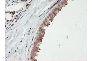 Immunohistochemical staining of paraffin-embedded Human breast tissue using anti-ENPEP mouse monoclonal antibody.