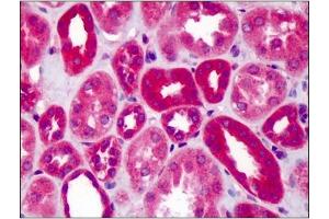 Image no. 1 for anti-Slit Homolog 1 (SLIT1) (AA 487-504) antibody (ABIN303378) (SLIT1 antibody  (AA 487-504))