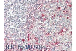 IHC-P analysis of Human Spleen Tissue, with HE staining. (CD86 antibody  (AA 46-282))