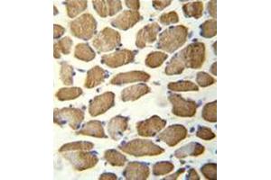 Immunohistochemistry analysis in formalin fixed and paraffin embedded human skeletal muscle reacted with hCG_1645727 Antibody (C-term) followed by peroxidase conjugation of the secondary antibody and DAB staining. (KBTBD13 antibody  (C-Term))