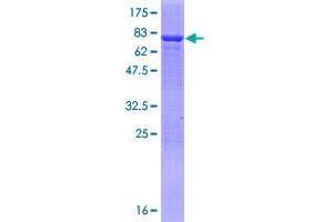 AMDHD2 Protein (AA 1-439) (GST tag)