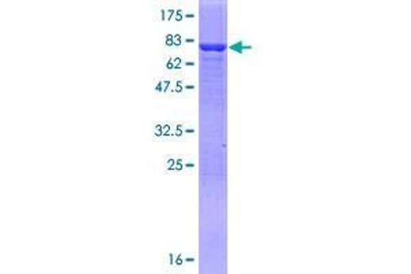 AMDHD2 Protein (AA 1-439) (GST tag)
