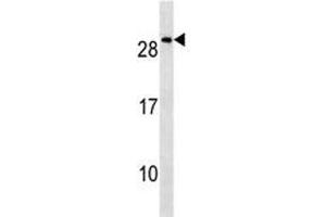 NKX2. (NKX2-8 antibody  (AA 2-8))