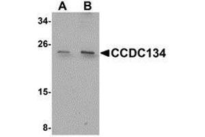 Western blot analysis of CCDC134 in rat brain tissue lysate with AP30210PU-N CCDC134 antibody at (A) 1 and (B) 2 μg/ml. (CCDC134 antibody  (N-Term))