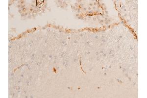 Immunohistochemistry (IHC) image for anti-Checkpoint Kinase 2 (CHEK2) (pThr68) antibody (ABIN6256592)