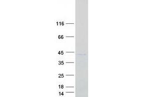 Validation with Western Blot (IMP4 Protein (Myc-DYKDDDDK Tag))