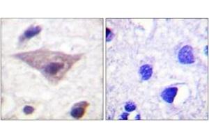Immunohistochemistry analysis of paraffin-embedded human brain, using Synuclein (Phospho-Ser129) Antibody. (Synuclein antibody  (pSer129))