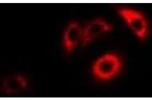 Immunofluorescent analysis of ERp46 staining in HepG2 cells. (TXNDC5 antibody)
