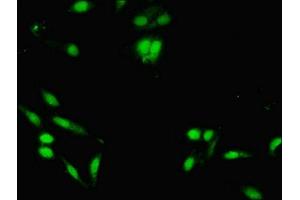 Immunofluorescent analysis of Hela cells using ABIN7158708 at dilution of 1:100 and Alexa Fluor 488-congugated AffiniPure Goat Anti-Rabbit IgG(H+L) (KDM5A antibody  (AA 437-603))