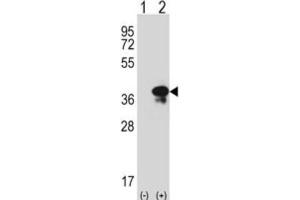 Western Blotting (WB) image for anti-Syntaxin 3 (STX3) antibody (ABIN3001650) (STX3 antibody)