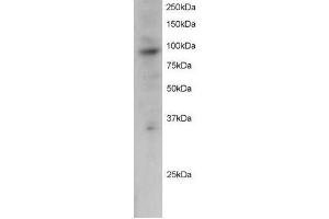 Image no. 1 for anti-PML-RARA Regulated Adaptor Molecule 1 (PRAM1) (C-Term) antibody (ABIN374107) (PRAM1 antibody  (C-Term))