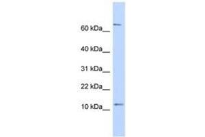 Image no. 1 for anti-Nuclear Receptor 2C2-Associated Protein (NR2C2AP) (N-Term) antibody (ABIN6741243)