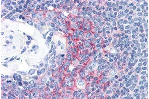 Human Spleen (formalin-fixed, paraffin-embedded) stained with ICAM1 antibody ABIN337366 at 10 ug/ml followed by biotinylated anti-mouse IgG secondary antibody ABIN481714, alkaline phosphatase-streptavidin and chromogen. (ICAM1 antibody)