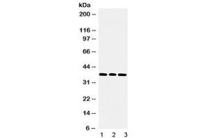 Western blot testing of 1) rat brain, 2) mouse NIH 3T3 and 3) human U-2 OS lysate with LDHB antibody at 0. (LDHB antibody)
