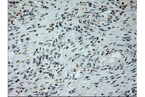Immunohistochemical staining of paraffin-embedded lung tissue using anti-L1CAMmouse monoclonal antibody. (L1CAM antibody)