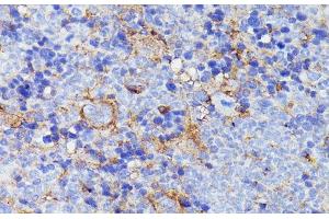Immunohistochemistry of paraffin-embedded Mouse spleen using SNAP23 Polyclonal Antibody at dilution of 1:100 (40x lens). (SNAP23 antibody)