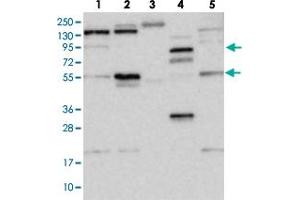 Western blot analysis of WDR44 polyclonal antibody .
