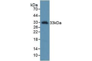 Detection of Recombinant KLK2, Human using Monoclonal Antibody to Kallikrein 2 (KLK2) (Kallikrein 2 antibody  (AA 19-261))