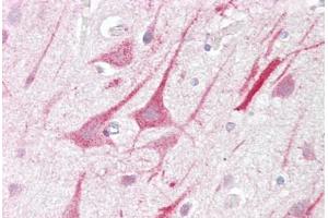 Anti-ZMYM2 antibody IHC staining of human brain, cortex. (ZMYM2 antibody  (C-Term))