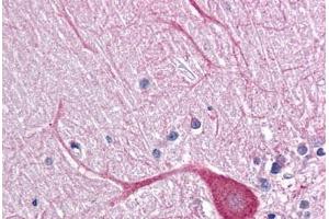 Human Brain, Cerebellum: Formalin-Fixed, Paraffin-Embedded (FFPE) (TLR3 antibody  (AA 514-657))