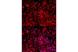 Immunofluorescence (IF) image for anti-Interleukin Enhancer Binding Factor 2, 45kDa (ILF2) antibody (ABIN1980249) (ILF2 antibody)