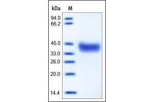 Mouse EpCAM, His Tag on SDS-PAGE under reducing (R) condition. (EpCAM Protein (AA 24-266) (His tag))